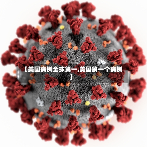 【美国病例全球第一,美国第一个病例】