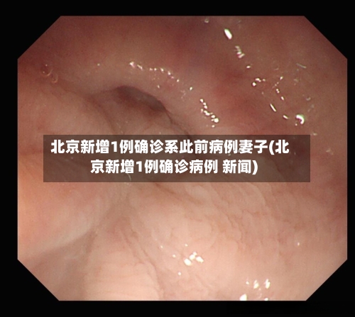 北京新增1例确诊系此前病例妻子(北京新增1例确诊病例 新闻)-第2张图片